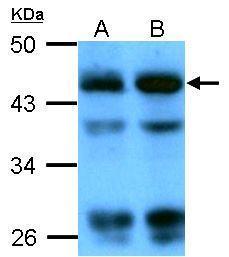 Anti-beta Actin antibody used in Western blot. GTX109639