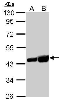 Anti-beta Actin antibody used in Western blot. GTX109639