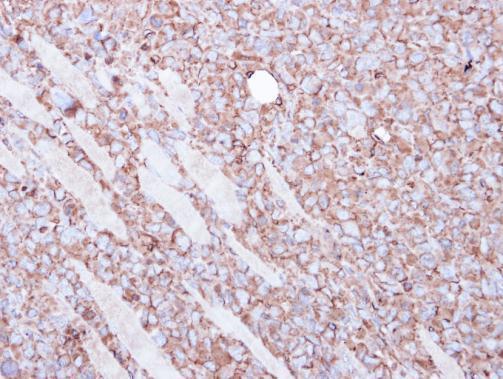 Anti-beta Actin antibody used in IHC (Formalin-fixed paraffin-embedded sections). GTX109639