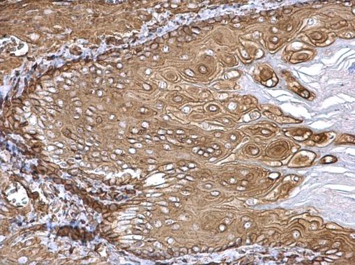 Anti-beta Actin antibody used in IHC (Formalin-fixed paraffin-embedded sections). GTX124212