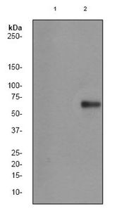Anti-beta Catenin (phospho Thr41/Ser45) antibody [EP1905Y] used in Western blot. GTX61958