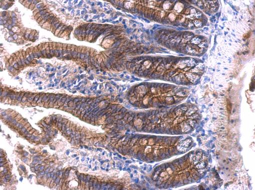 Anti-beta Catenin antibody used in IHC (Formalin-fixed paraffin-embedded sections). GTX101254