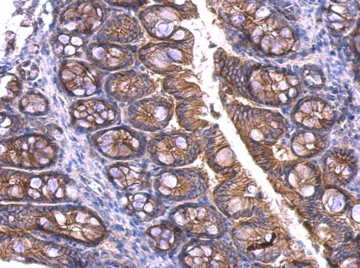 Anti-beta Catenin antibody used in IHC (Formalin-fixed paraffin-embedded sections). GTX101254