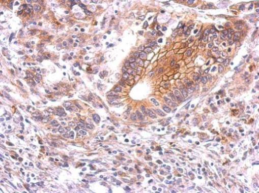 Anti-beta Catenin antibody used in IHC (Formalin-fixed paraffin-embedded sections). GTX101254