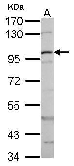 Anti-beta Catenin antibody used in Western blot. GTX101254