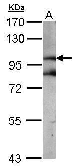 Anti-beta Catenin antibody used in Western blot. GTX101254
