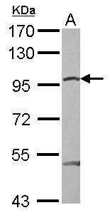 Anti-beta Catenin antibody used in Western blot. GTX110594