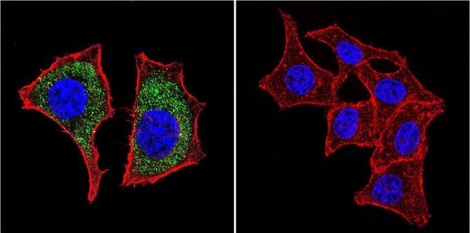 Anti-beta Catenin antibody [9F2] used in ICC/IF. GTX80686