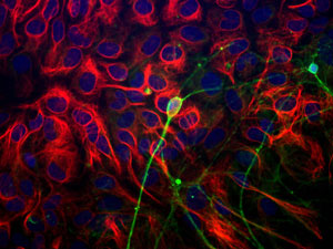 Anti-beta III Tubulin antibody used in ICC/IF. GTX85469