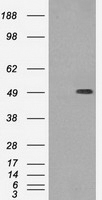 Anti-beta III Tubulin antibody [5H2] used in Western blot. GTX83460