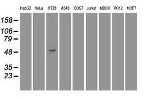 Anti-beta III Tubulin antibody [5H2] used in Western blot. GTX83460