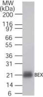 Anti-BEX2 antibody [9E1237] used in Western blot. GTX13813