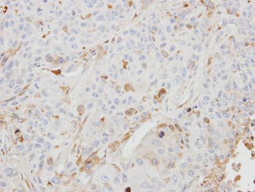 Anti-BHMT2 antibody [N1C3] used in IHC (Formalin-fixed paraffin-embedded sections). GTX104145