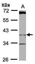 Anti-BHMT2 antibody [N1C3] used in Western blot. GTX104145