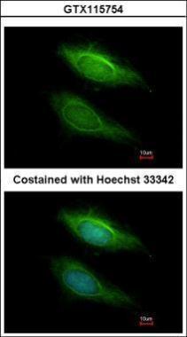 Anti-BHMT2 antibody [N2C3] used in ICC/IF. GTX115754