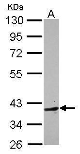 Anti-BHMT2 antibody [N2C3] used in Western blot. GTX115754