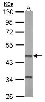 Anti-BHMT2 antibody [N2C3] used in Western blot. GTX115754