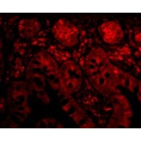 Anti-Bit1 antibody used in ICC/IF. GTX85497