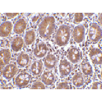 Anti-Bit1 antibody used in Immunohistochemistry. GTX85497