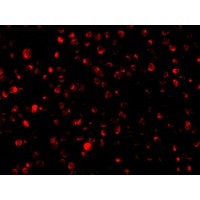 Anti-Bit1 antibody used in ICC/IF. GTX85498