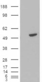 Anti-BLNK / SLP-65 antibody, C-term used in Western blot. GTX89949