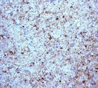 Anti-BM88 antibody [EPR3739] used in Immunohistochemistry. GTX62312