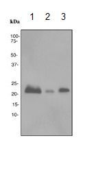 Anti-BM88 antibody [EPR3739] used in Western blot. GTX62312