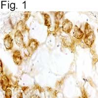 Anti-Bombesin Receptor 3 antibody used in Immunohistochemistry. GTX79490