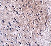 Anti-Bora antibody used in Immunohistochemistry. GTX85293
