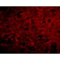 Anti-Bora antibody used in ICC/IF. GTX85293