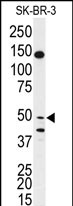Anti-BPIL1 antibody, N-term used in Western blot. GTX81461