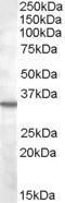 Anti-Bradykinin receptor B1 antibody, Internal used in Western blot. GTX88647