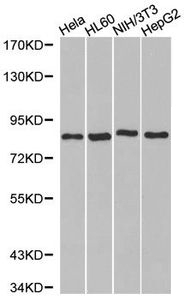 Anti-B-Raf antibody used in Western blot. GTX30093