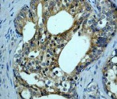 Anti-B-Raf antibody [EP152Y] used in Immunohistochemistry. GTX61277