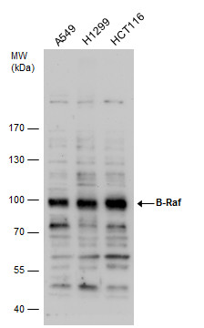 Anti-B-Raf antibody [N2C1], Internal used in Western blot. GTX100913