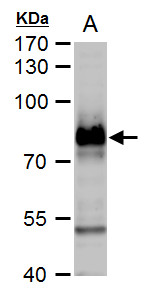Anti-B-Raf antibody [N2C1], Internal used in Western blot. GTX100913