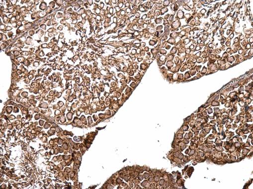 Anti-B-Raf antibody [N2C1], Internal used in IHC (Formalin-fixed paraffin-embedded sections). GTX100913