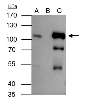Anti-B-Raf antibody [N2C1], Internal used in Immunoprecipitation. GTX100913