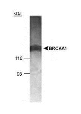 Anti-BRCAA1 antibody used in Western blot. GTX30623