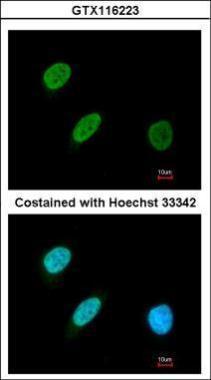Anti-BRF2 antibody [N1C1] used in ICC/IF. GTX116223