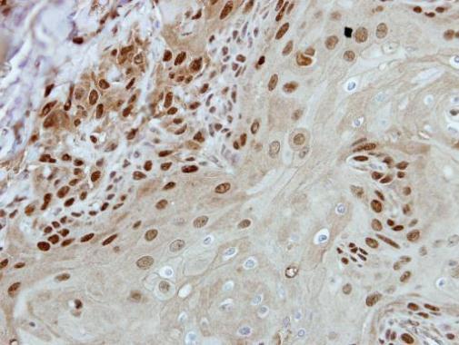 Anti-BRF2 antibody [N1C1] used in IHC (Formalin-fixed paraffin-embedded sections). GTX116223