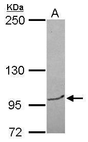Anti-BRPF3 antibody [N1N2], N-term used in Western blot. GTX121388