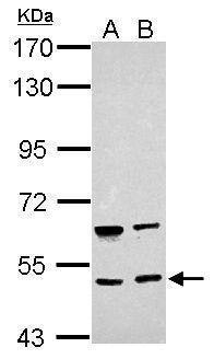 Anti-BRUNOL4 antibody used in Western blot. GTX121390