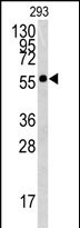 Anti-BTBD1 antibody, Internal used in Western blot. GTX81529