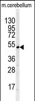 Anti-BTBD1 antibody, Internal used in Western blot. GTX81529