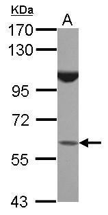 Anti-BTBD16 antibody [N1C1] used in Western blot. GTX120539