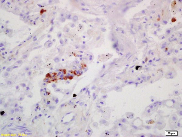 Anti-BTBD3 antibody used in IHC (Formalin-fixed paraffin-embedded sections). GTX51972