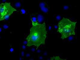 Anti-BTN3A2 antibody [1A6] used in ICC/IF. GTX84773