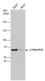 Anti-C10orf119 antibody used in Western blot. GTX120103