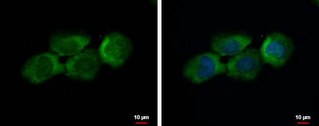 Anti-C12orf11 antibody used in ICC/IF. GTX120137